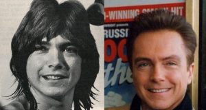 David Cassidy Connection Alcohol Dementia?