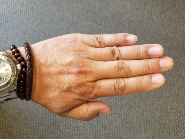 Longer Ring/Index Finger Promotes CoronaVirus Resistance!